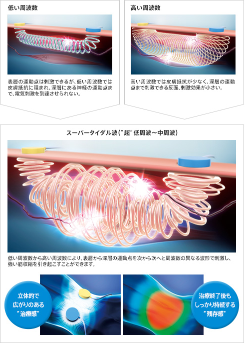 ひろみの介護]デイサービスと低周波治療器 – ひろみの介護